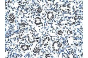 Image no. 1 for anti-Homeobox B9 (HOXB9) (AA 67-116) antibody (ABIN6735813) (HOXB9 antibody  (AA 67-116))