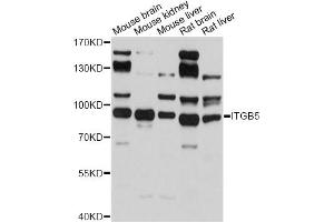 Western blot analysis of extracts of various cell lines, using ITGB5 antibody (ABIN5971332) at 1/500 dilution. (Integrin beta 5 antibody)