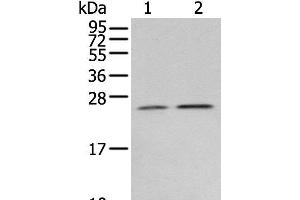 Western blot analysis of Human fetal brain tissue 231 cell using RAB11A Polyclonal Antibody at dilution of 1:400 (RAB11A antibody)