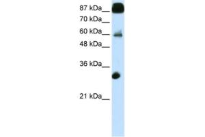 Western Blotting (WB) image for anti-CCCTC-Binding Factor (Zinc Finger Protein) (CTCF) antibody (ABIN2461796) (CTCF antibody)