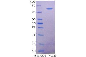 SDS-PAGE (SDS) image for 5'-Nucleotidase, Ecto (CD73) (NT5E) protein (ABIN1078683)