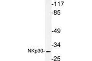Western blot (WB) analysis of NKp30 antibody in extracts from A549 cells. (NCR3 antibody)
