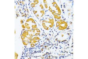 Immunohistochemistry (Paraffin-embedded Sections) (IHC (p)) image for anti-Matrix Metalloproteinase 2 (MMP2) (AA 40-280) antibody (ABIN6143911)
