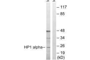 Western blot analysis of extracts from Jurkat cells, treated with insulin (0. (CBX5 antibody  (Ser92))