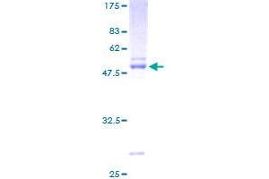 Image no. 1 for Ephrin A3 (EFNA3) (AA 1-238) protein (GST tag) (ABIN1352401) (Ephrin A3 Protein (EFNA3) (AA 1-238) (GST tag))