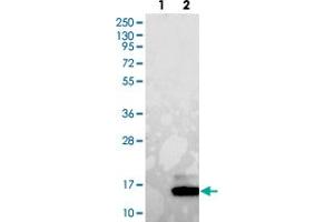 Western blot analysis of Lane 1: Negative control (vector only transfected HEK293T lysate). (GUCA2A antibody)