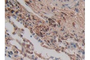 Immunohistochemistry (IHC) image for anti-Cytohesin 1 (CYTH1) (AA 1-398) antibody (ABIN7443203)