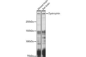 Western blot analysis of extracts of various cell lines, using Dystrophin antibody (ABIN1679546, ABIN3015473, ABIN3015474 and ABIN6218357) at 1:1000 dilution. (Dystrophin antibody  (AA 346-635))