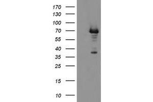 HEK293T cells were transfected with the pCMV6-ENTRY control (Left lane) or pCMV6-ENTRY PGM3 (Right lane) cDNA for 48 hrs and lysed. (Phosphoglucomutase 3 antibody)