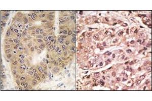 Image no. 1 for anti-Small Ubiquitin Related Modifier 4 (SUMO4) (Met55Val-Mutant) antibody (ABIN356787) (SUMO4 antibody  (Met55Val-Mutant))