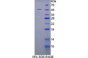 SDS-PAGE analysis of Rabbit MSE Protein. (MSE Protein)