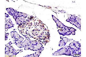 Formalin-fixed and paraffin embedded rat pancreas labeled with Anti NOX2/gp91phox Polyclonal Antibody, Unconjugated (ABIN750688) at 1:200 followed by conjugation to the secondary antibody and DAB staining