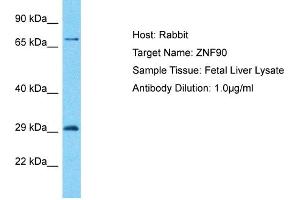 Host: Rabbit Target Name: ZNF90 Sample Type: Fetal Liver lysates Antibody Dilution: 1.
