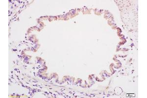 Formalin-fixed and paraffin embedded rat brain tissue labeled with Anti-CYBR1 Polyclonal Antibody, Unconjugated (ABIN1386135) at 1:200, followed by conjugation to the secondary antibody and DAB staining (Cytochrome B Reductase 1 antibody  (AA 51-150))