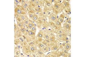 Immunohistochemistry of paraffin-embedded human liver injury using OGT antibody at dilution of 1:100 (x40 lens). (OGT antibody)