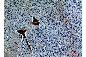 Immunohistochemistry (IHC) analysis of paraffin-embedded Human Brain, antibody was diluted at 1:100. (FGF17 antibody  (Internal Region))