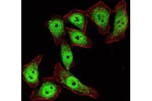 Immunofluorescence analysis of ECA109 cells using KLF4 mouse mAb (green). (KLF4 antibody)