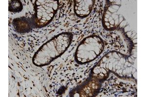 Immunoperoxidase of monoclonal antibody to TRAM2 on formalin-fixed paraffin-embedded human colon. (TRAM2 antibody  (AA 310-369))