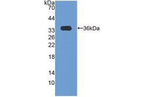 Western blot analysis of recombinant Human CCND3. (Cyclin D3 antibody  (AA 1-292))