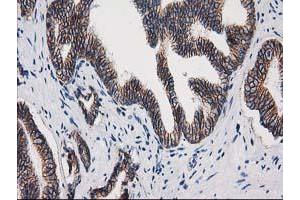 Image no. 4 for anti-Catenin (Cadherin-Associated Protein), beta 1, 88kDa (CTNNB1) antibody (ABIN1496890) (CTNNB1 antibody)