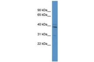 Image no. 1 for anti-T-Box 10 (TBX10) (AA 127-176) antibody (ABIN6746048) (T-Box 10 antibody  (AA 127-176))