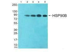 Western blot analysis of extracts from HeLa cells (Lane 2), CoLo cells (Lane 3), HepG2 cells (Lane 4) and 293 cells (Lane 5), using HSP90B (Ab-254) antiobdy. (HSP9AB1 (Ser254) antibody)