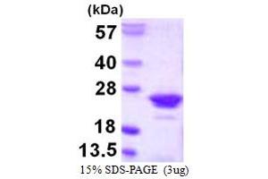 SDS-PAGE (SDS) image for Regulator of G-Protein Signaling 10 (RGS10) (AA 1-181) protein (His tag) (ABIN667506)