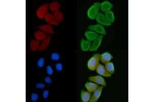 ABIN6260466 and ABIN6272266 staining Hela cells(30 min of UV treatment) by IF/ICC. (CSNK1G1 antibody  (C-Term))