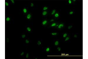 Immunofluorescence of monoclonal antibody to GTF2I on HeLa cell. (GTF2I antibody  (AA 36-274))