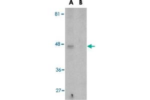 Western blot analysis of APOBEC3G expression in Caco-2 cell lysate in the (A), absence and (B) presence of blocking peptide with APOBEC3G polyclonal antibody  at 5 ug/mL . (APOBEC3G antibody  (N-Term))
