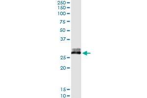 Immunoprecipitation of CFHR2 transfected lysate using anti-CFHR2 MaxPab rabbit polyclonal antibody and Protein A Magnetic Bead , and immunoblotted with CFHR2 purified MaxPab mouse polyclonal antibody (B02P) . (CFHR2 antibody  (AA 1-270))