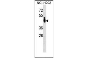 Western blot analysis of PABPC4L Antibody (C-term) in NCI-H292 cell line lysates (35ug/lane). (PABPC4L antibody  (C-Term))