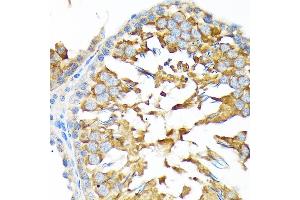 Immunohistochemistry of paraffin-embedded rat testis using  Rabbit mAb (ABIN7265532) at dilution of 1:100 (40x lens). (ALDH1A2 antibody)