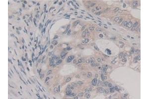 Immunohistochemistry (IHC) image for anti-Fission 1 (FIS1) (AA 1-117) antibody (ABIN7436618)