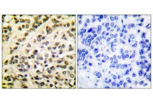 Immunohistochemistry (IHC) image for anti-Friend Leukemia Virus Integration 1 (FLI1) (Internal Region) antibody (ABIN1848550) (FLI1 antibody  (Internal Region))