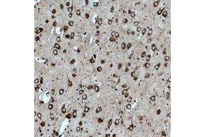 Immunohistochemical analysis of CACNG3 staining in rat brain formalin fixed paraffin embedded tissue section. (CACNG3 antibody)