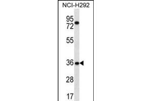 TSGA13 Antibody (C-term) (ABIN656582 and ABIN2845844) western blot analysis in NCI- cell line lysates (35 μg/lane). (TSGA13 antibody  (C-Term))