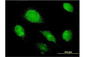 Image no. 1 for anti-alpha 1 Microglobulin/bikunin precursor (AMBP) (AA 19-353) antibody (ABIN598537) (AMBP antibody  (AA 19-353))