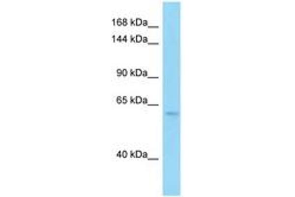 PDE6B antibody  (AA 372-421)