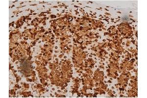 ABIN6256714 and ABIN6267384 at 1/200 staining Rat ganstric tissue sections by IHC-P. (Ezrin antibody  (pTyr353, pTyr354))