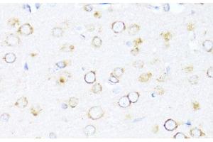 Immunohistochemistry of paraffin-embedded Rat brain using DNAJB11 Polyclonal Antibody at dilution of 1:100 (40x lens).