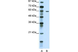 WB Suggested Anti-TRIM62 Antibody Titration:  1. (TRIM62 antibody  (N-Term))