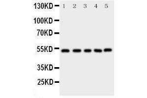 Western Blotting (WB) image for anti-SMAD, Mothers Against DPP Homolog 5 (SMAD5) (AA 248-267), (Middle Region) antibody (ABIN3043980)