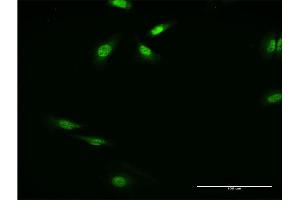 Immunofluorescence of monoclonal antibody to RFXANK on HeLa cell.