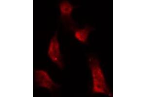 ABIN6267677 staining NIH-3T3 by IF/ICC. (ATRIP antibody  (pSer68))