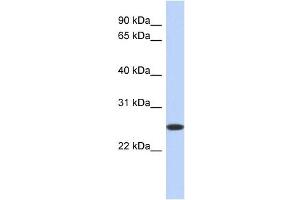 BLVRB antibody used at 1 ug/ml to detect target protein. (BLVRB antibody  (Middle Region))
