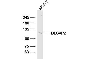 MCF-7 lysates probed with DLGAP2 Polyclonal Antibody, Unconjugated  at 1:300 dilution and 4˚C overnight incubation. (DLGAP2 antibody  (AA 251-360))