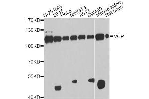 Western blot analysis of extracts of various cell lines, using VCP antibody. (VCP antibody)
