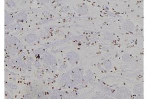 ABIN6266276 and ABIN6277441 at 1/100 staining Rat brain tissue by IHC-P. (SUMO4 antibody  (Internal Region))