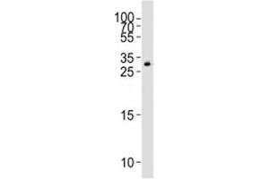 Western blot analysis of lysate from HT-1080 cell line using GDF15 antibody (GDF15 antibody  (C-Term))